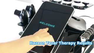 RL-W20 Hazeon Tecar Terapi Makinesi – Gelişmiş 448kHz Fizyoterapi ve Rehabilitasyon Cihazı
