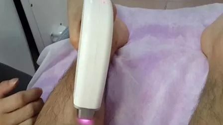 Rekabetçi Fiyatlı 808nm Diyot Lazer Saç Kaldırma Makinesi 1-50A Enerji ve Salon Kullanımı İçin 1-400ms Nabız Genişliği